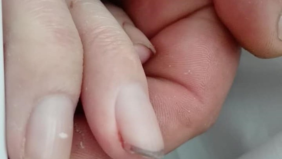 Recibió una bala perdida y agoniza en el hospital: “Mi hijo es tratado como un trapo sucio”