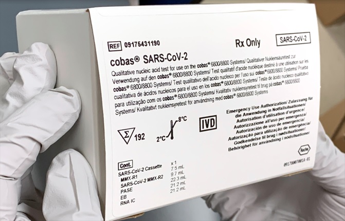 Coronavirus: lanzan una prueba que detecta si el paciente es positivo en tres horas y media