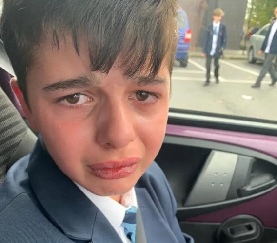 Una mujer sacó a su hijo autista de la escuela tras recibir un feroz bullying