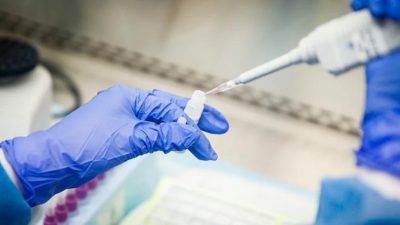 El Gobierno anunció la llegada de 31.000 reactivos para detectar casos de coronavirus