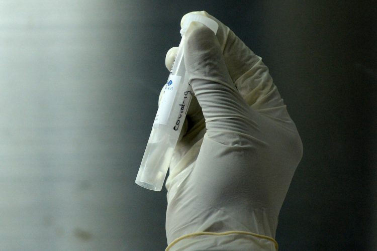 Reconstruir el “árbol genealógico” genético del virus para fechar su aparición