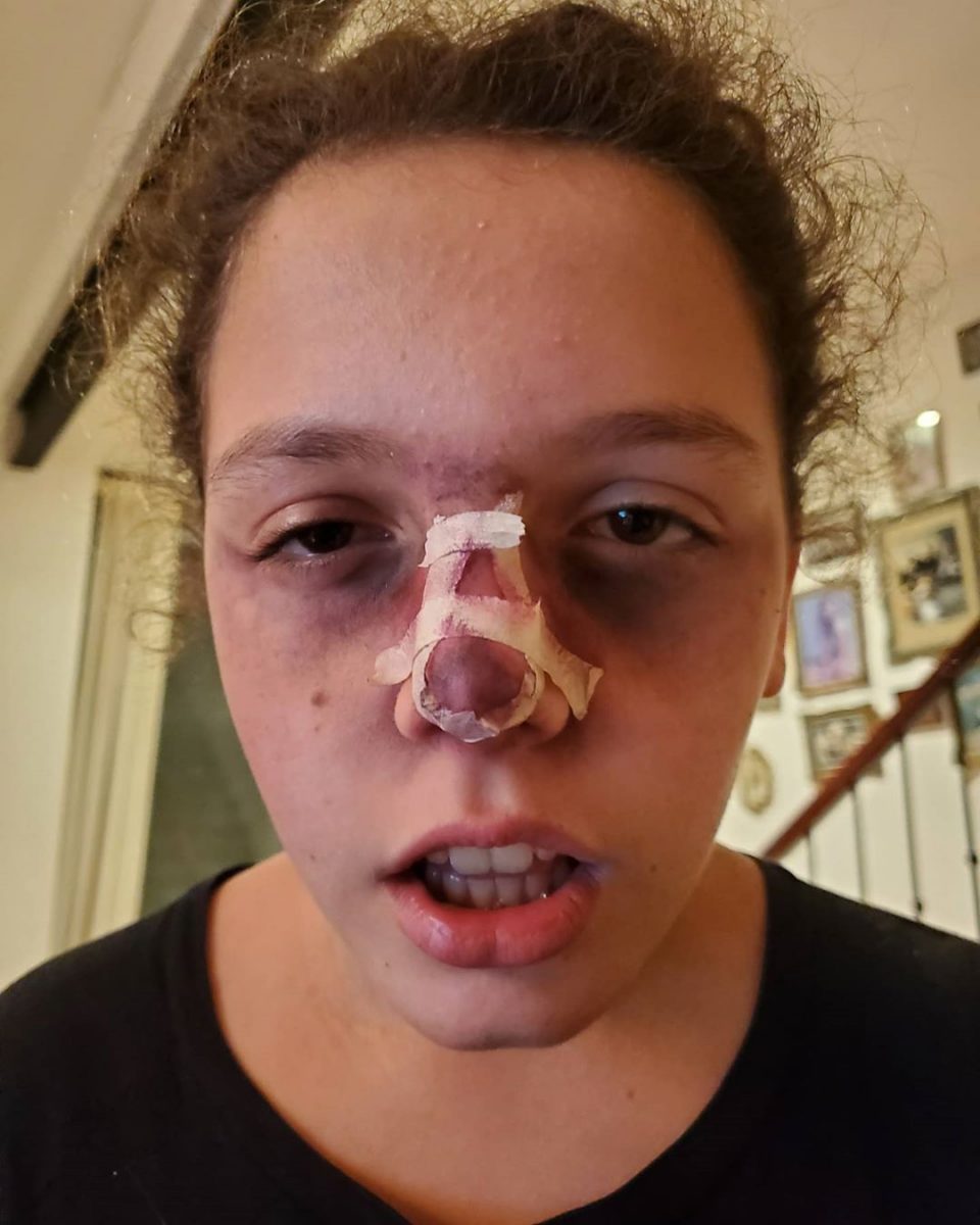 La foto de la hija de Campi que aterrorizó a los seguidores del humorista