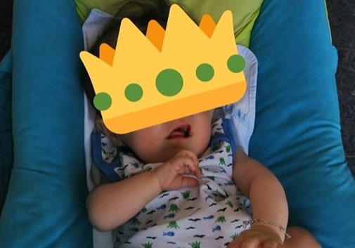 El “bebé sin rostro” cumplió siete meses a pesar de haberle diagnosticado pocas horas de vida