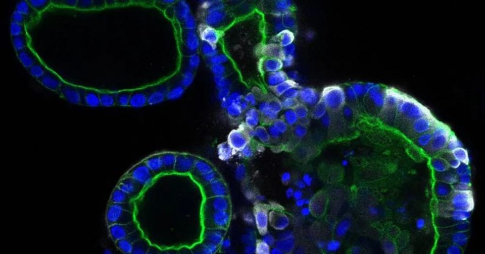 Descubrieron que el coronavirus puede infectar y multiplicarse en el intestino