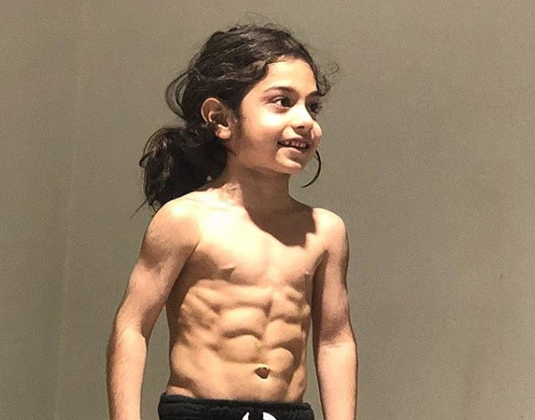 Arat Hosseini, el niño iraní prodigio que impacta por su estado físico en las redes sociales
