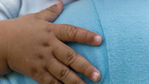 Murió una bebé después de tomar sangre de tortuga: les dijeron que prevenía el coronavirus