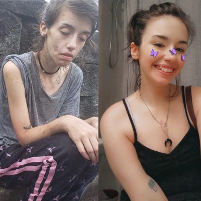 Una joven logró vencer su adicción a las drogas y mostró su recuperación con un conmovedor mensaje