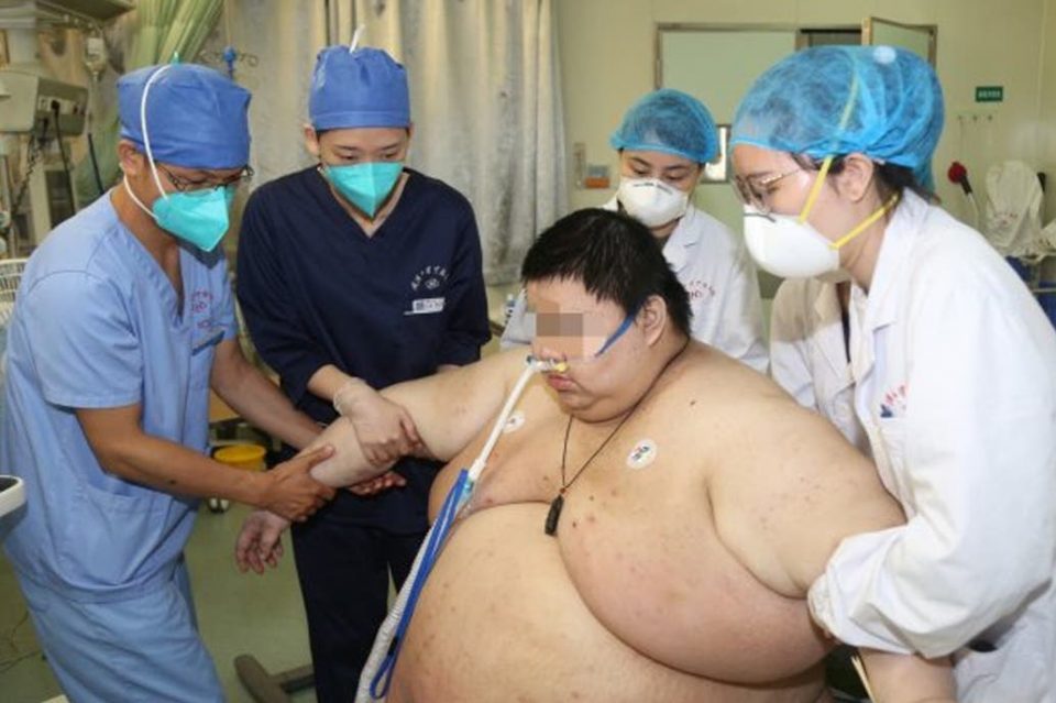 Cuarentena: un hombre engordó 100 kilos durante el confinamiento