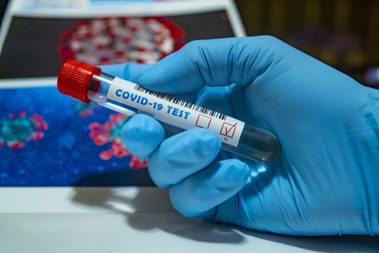 Tests PCR, pruebas serológicas: ¿Cómo saber si tenemos la Covid-19?