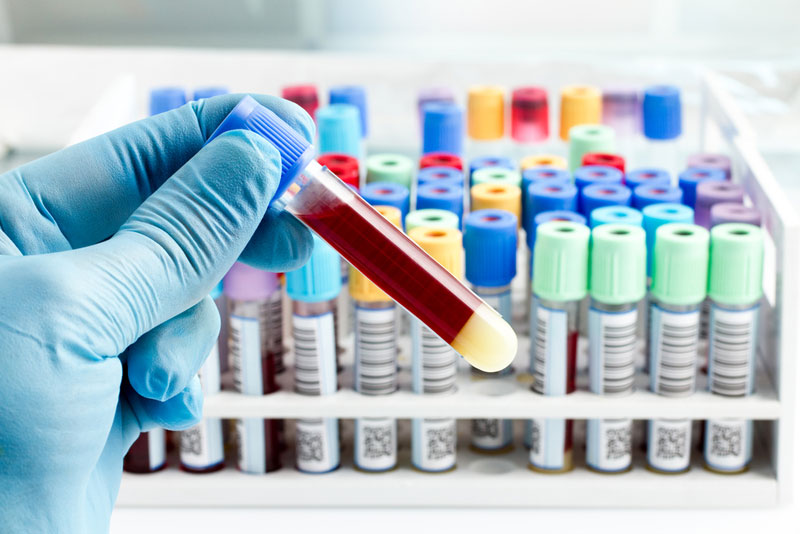Coronavirus: un estudio advierte que el grupo sanguíneo podría determinar la gravedad de la enfermedad