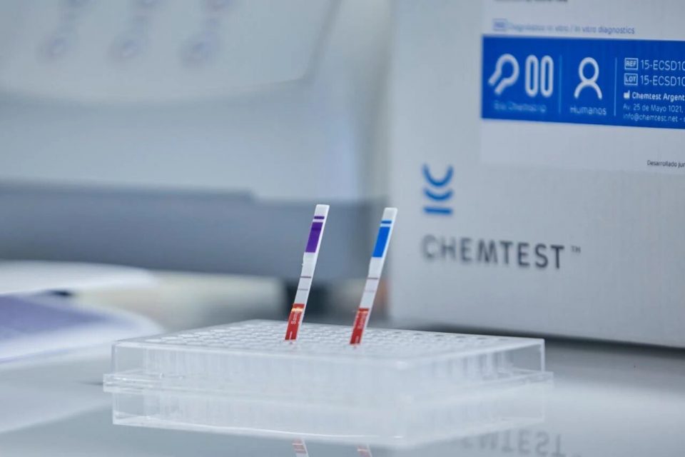 Coronavirus: comenzaron a distribuir en hospitales públicos los test rápidos creados por científicos argentinos