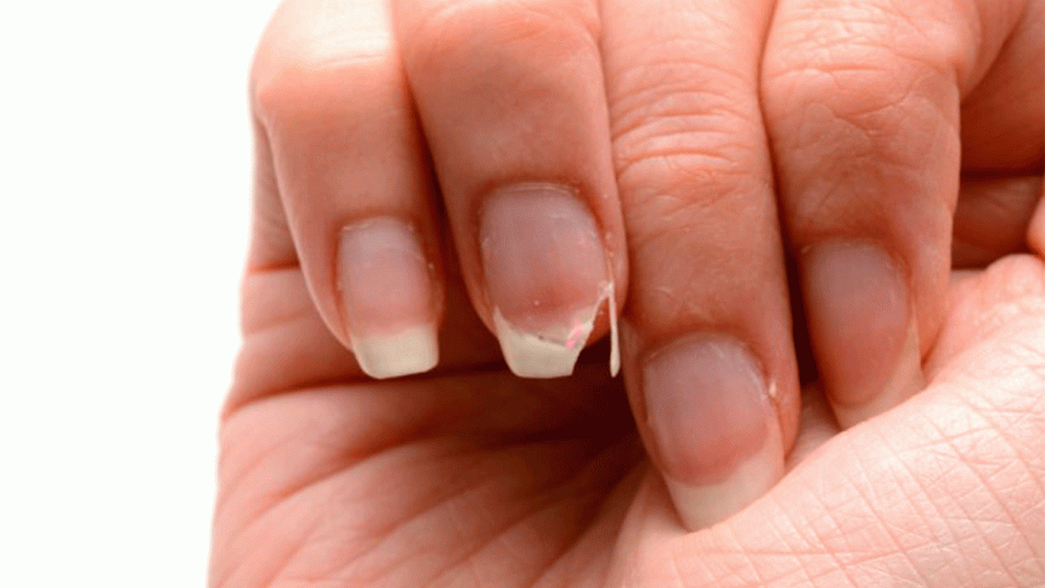 ¿Uñas quebradizas? El esmalte de ajo podría ser la solución a ese problema