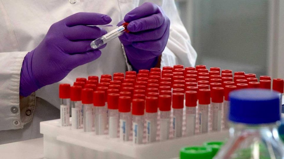 La ANMAT aprobó el ensayo clínico de un suero argentino para combatir el coronavirus