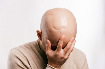 Un estudio reveló que los hombres con calvicie tiene un 40% más de chances de tener coronavirus