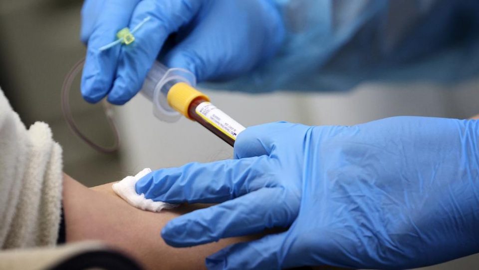 Ataques cardíacos o derrames cerebrales: advierten sobre los posibles efectos del coronavirus en la sangre