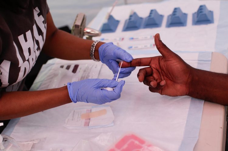 La pandemia de Covid19 puede echar por tierra los avances contra el VIH