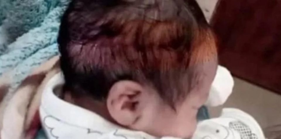 “Le cortaron la mitad de su cabecita”: en la cesárea le hicieron un tajo a su hijo e intentaron ocultarle la situación