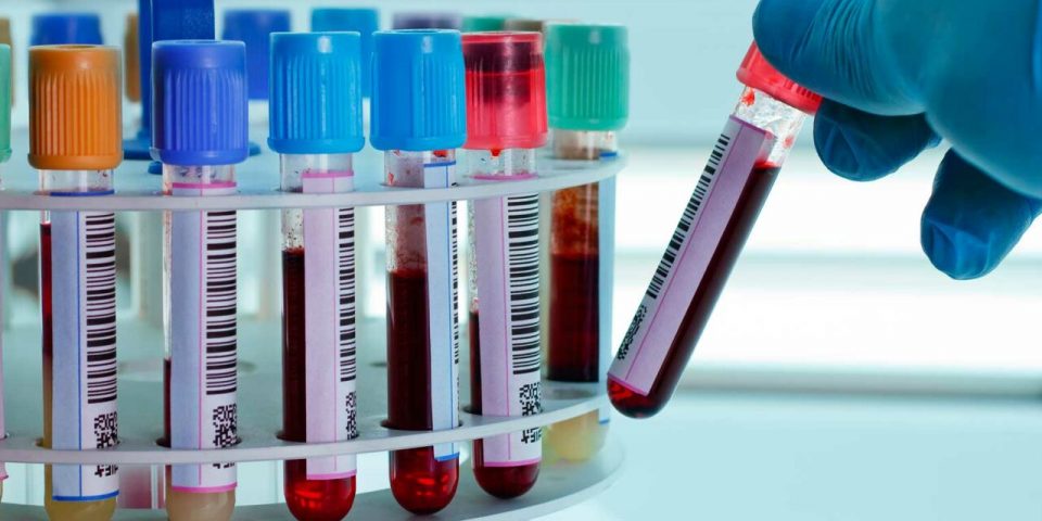 Una científica argentina creó un kit para detectar el cáncer de mama y de próstata antes que otros análisis