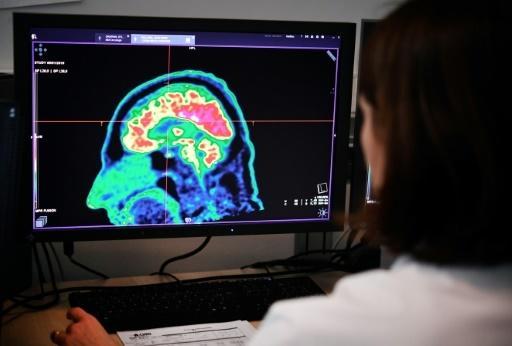 Los síntomas neurológicos de la Covid-19: dolor de cabeza, anosmia y mialgias, entre otros