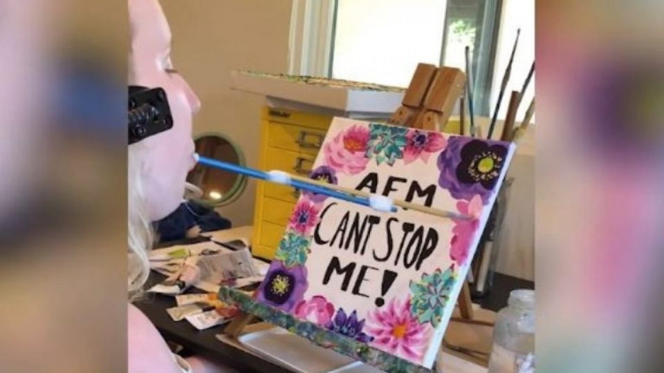 Perdió la movilidad en todo el cuerpo, pero eso no le impidió desarrollarse como artista