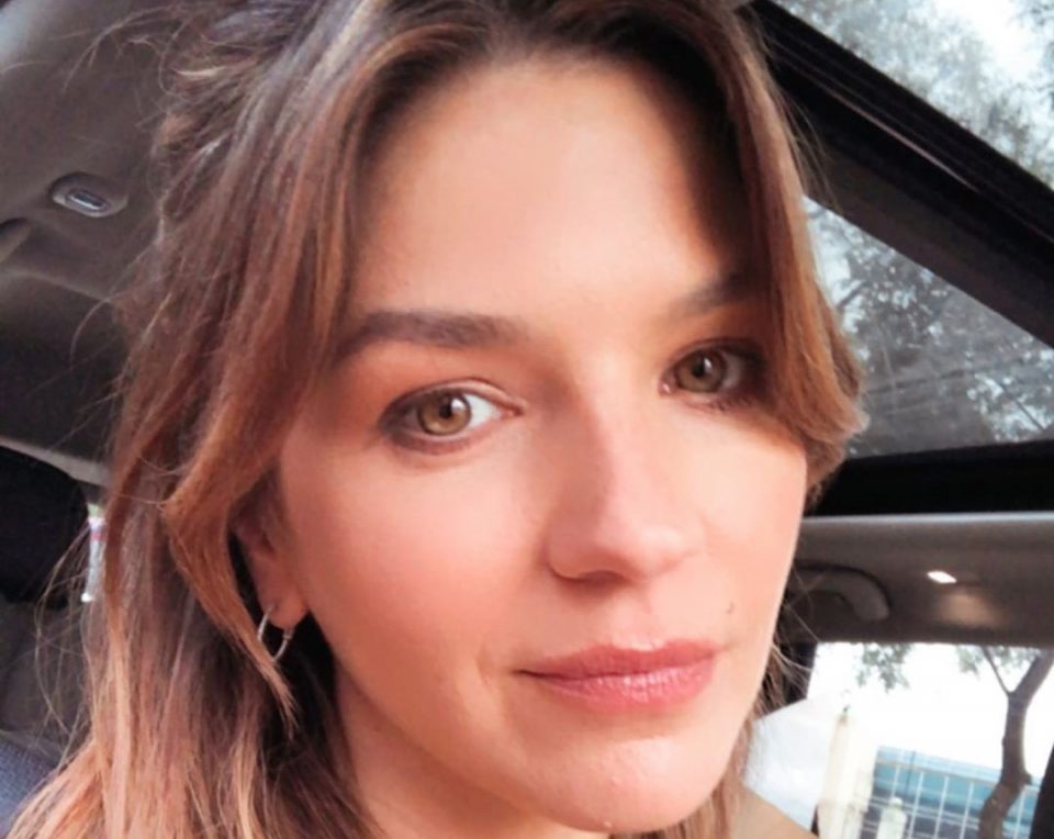 Marcela Kloosterboer mostró cómo quedó su rostro después de un accidente doméstico
