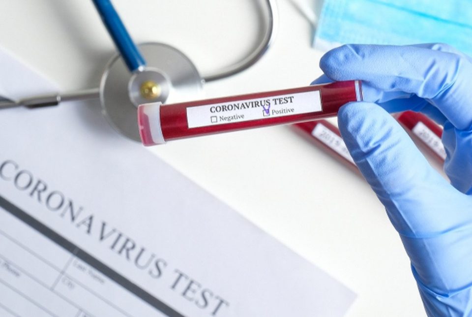 Coronavirus: crecen los casos de “portadores largos” del virus con síntomas que duran varios meses