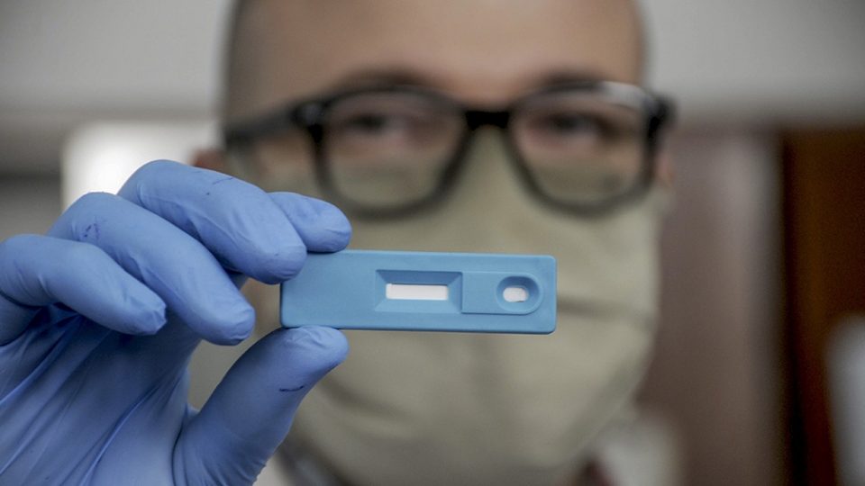 Científicos argentinos crearon un test que detecta el coronavirus en cinco minutos