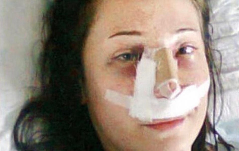 Fue a un hospital a operarse la nariz y le amputaron las dos piernas por un error