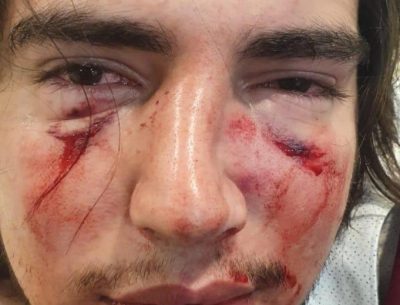 El violento episodio de los rugbiers: Habló el supuesto agresor
